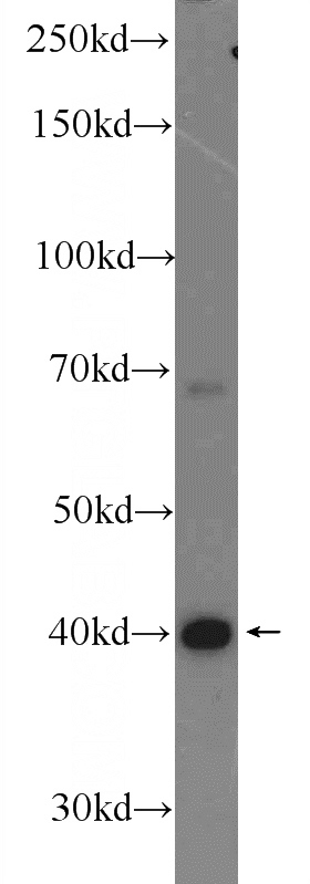 mouse liver tissue were subjected to SDS PAGE followed by western blot with Catalog No:111358(hIST1 Antibody) at dilution of 1:1000