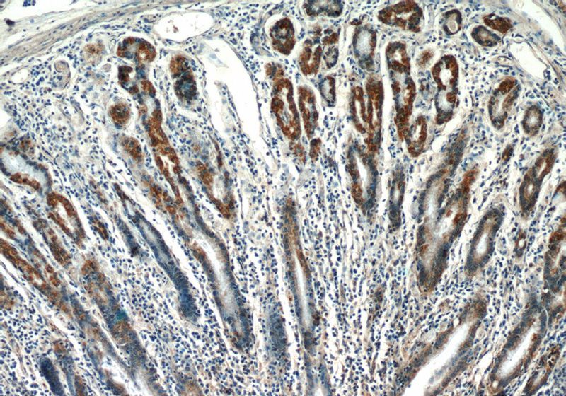 Immunohistochemistry of paraffin-embedded human stomach slide using Catalog No:107920(AIRE Antibody) at dilution of 1:50