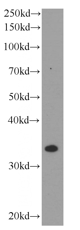 HeLa cells were subjected to SDS PAGE followed by western blot with Catalog No:107630(TNFAIP1 Antibody) at dilution of 1:500