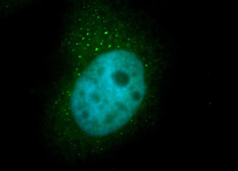 Immunofluorescent analysis of MCF-7 cells, using PSMB4 antibody Catalog No:114384 at 1:50 dilution and FITC-labeled donkey anti-rabbit IgG(green). Blue pseudocolor = DAPI (fluorescent DNA dye).