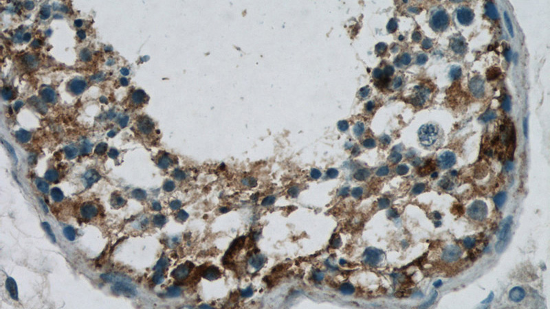 Immunohistochemistry of paraffin-embedded human testis tissue slide using Catalog No:109931(DHX35 Antibody) at dilution of 1:50 (under 40x lens)