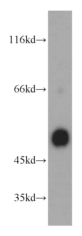 A431 cells were subjected to SDS PAGE followed by western blot with Catalog No:109663(CCNB2 antibody) at dilution of 1:500