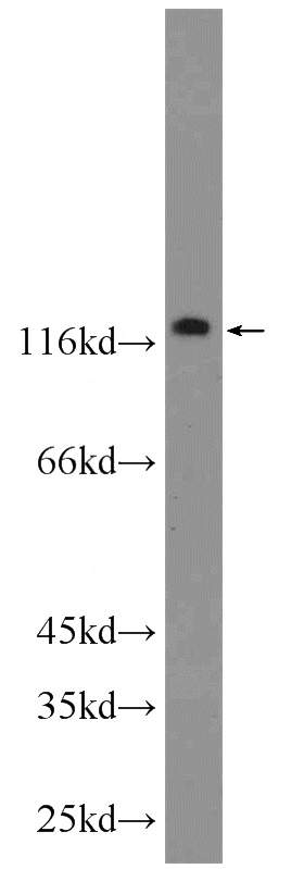 HeLa cells were subjected to SDS PAGE followed by western blot with Catalog No:116478(KIAA0406 Antibody) at dilution of 1:1000