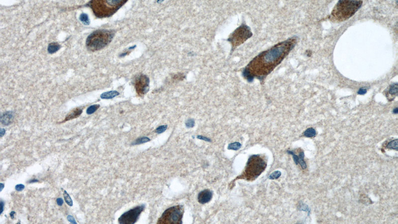 Immunohistochemical of paraffin-embedded human brain using Catalog No:113235(GRIN2B antibody) at dilution of 1:50 (under 40x lens)