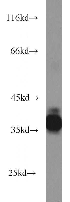 mouse eye tissue were subjected to SDS PAGE followed by western blot with Catalog No:114236(PRPH2 antibody) at dilution of 1:1000