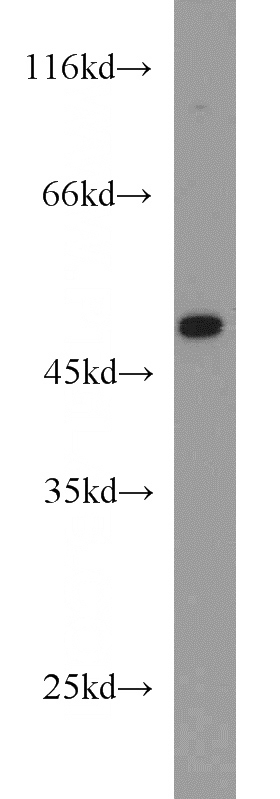 Jurkat cells were subjected to SDS PAGE followed by western blot with Catalog No:111166(GSDMD antibody) at dilution of 1:300