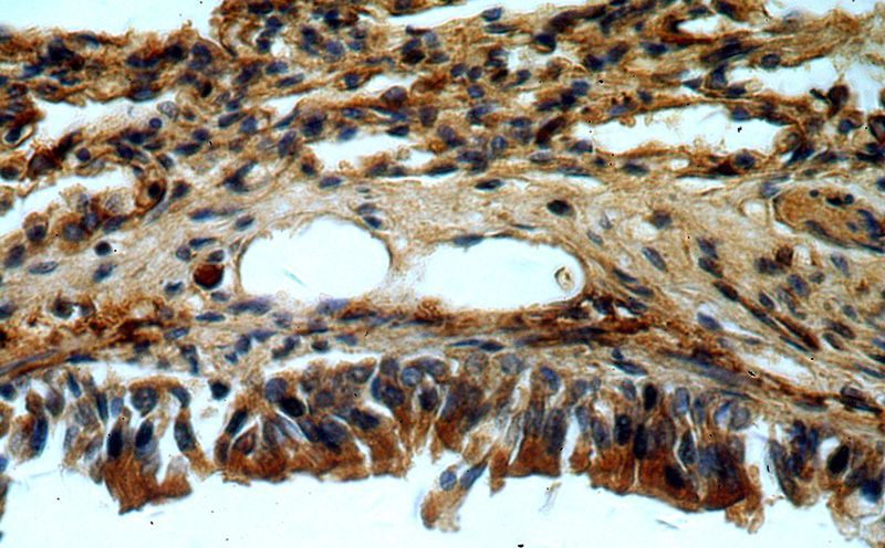 Immunohistochemical of paraffin-embedded human lung using Catalog No:108639(C11orf51 antibody) at dilution of 1:50 (under 40x lens)