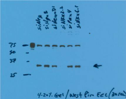 WB result of NKX2-2 antibody (Catalog No:113203) on Min6 cells with siNKX2-2, siPAX4, siNKX6-1 by Dr. Nicholas George, Sarvetnick Lab – UNMC. (the 70 kDa band is unknown)