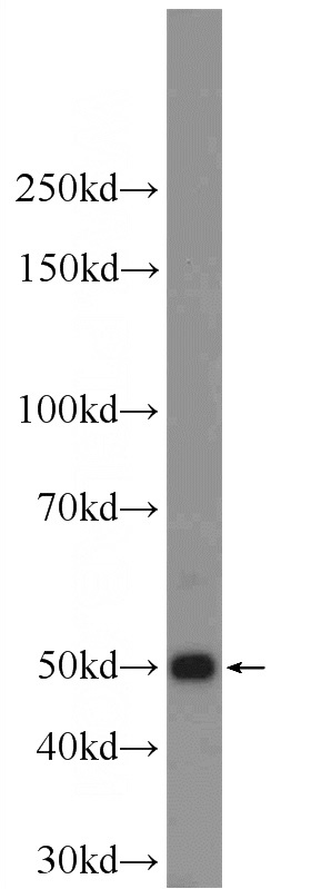 mouse eye tissue were subjected to SDS PAGE followed by western blot with Catalog No:112127(KRT12 Antibody) at dilution of 1:600