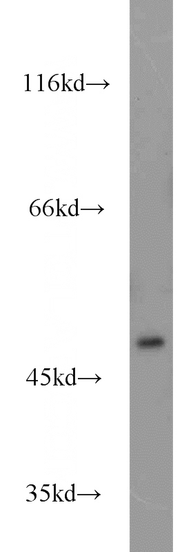Jurkat cells were subjected to SDS PAGE followed by western blot with Catalog No:109775(DDOST antibody) at dilution of 1:1200
