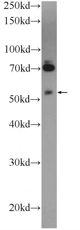 mouse lung tissue were subjected to SDS PAGE followed by western blot with Catalog No:116158(TNRC4 Antibody) at dilution of 1:1000