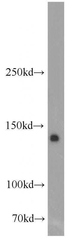 mouse brain tissue were subjected to SDS PAGE followed by western blot with Catalog No:110724(FLT3 antibody) at dilution of 1:500
