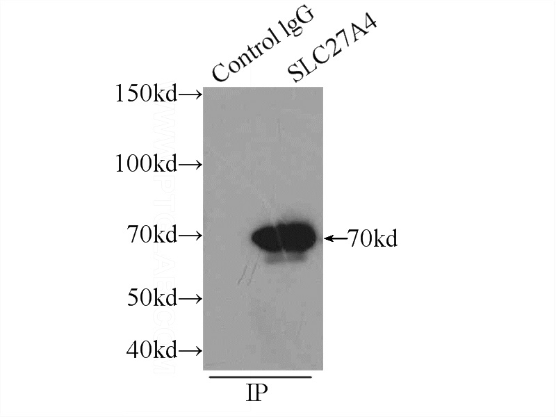IP Result of anti-SLC27A4 (IP:Catalog No:110533, 4ug; Detection:Catalog No:110533 1:500) with HepG2 cells lysate 1600ug.