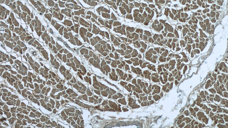 Immunohistochemistry of paraffin-embedded human heart tissue slide using Catalog No:115185(SH3BGR Antibody) at dilution of 1:50 (under 10x lens)