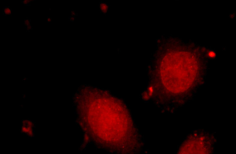 Immunofluorescent analysis of HeLa cells using Catalog No:111399(HELB Antibody) at dilution of 1:25 and Rhodamine-Goat anti-Rabbit IgG