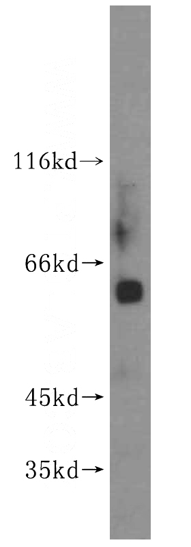human heart tissue were subjected to SDS PAGE followed by western blot with Catalog No:112635(MEF2C antibody) at dilution of 1:400