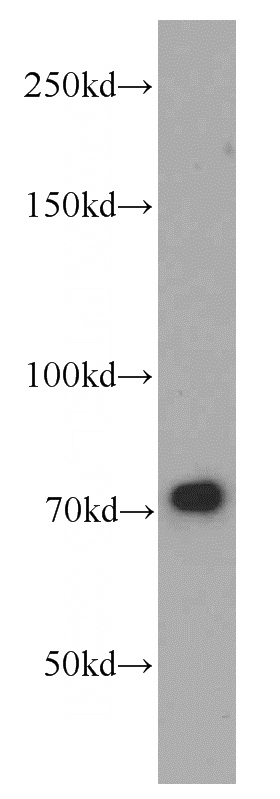 mouse lung tissue were subjected to SDS PAGE followed by western blot with Catalog No:113383(NUP85 antibody) at dilution of 1:400
