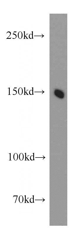 HepG2 cells were subjected to SDS PAGE followed by western blot with Catalog No:113691(PCDH11Y antibody) at dilution of 1:300