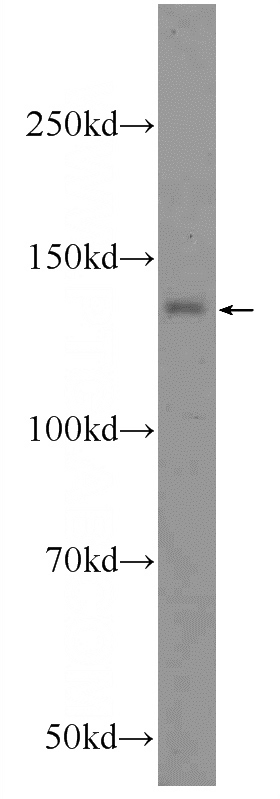 MCF-7 cells were subjected to SDS PAGE followed by western blot with Catalog No:108656(C14orf102 Antibody) at dilution of 1:600