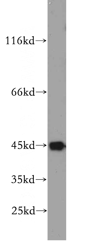 HeLa cells were subjected to SDS PAGE followed by western blot with Catalog No:115201(SERPINB12 antibody) at dilution of 1:500
