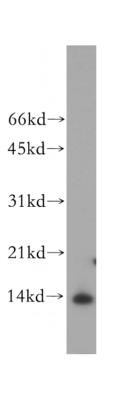 MCF7 cells were subjected to SDS PAGE followed by western blot with Catalog No:113863(PHPT1 antibody) at dilution of 1:500