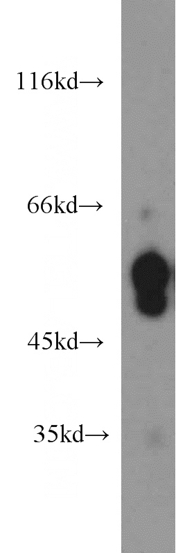 mouse brain tissue were subjected to SDS PAGE followed by western blot with Catalog No:108917(CAMK2B antibody) at dilution of 1:1000