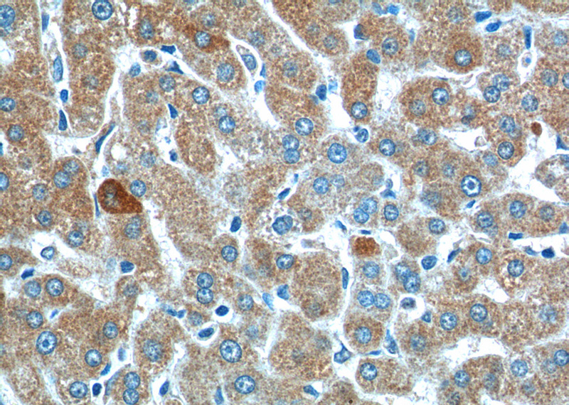 Immunohistochemistry of paraffin-embedded human liver tissue slide using Catalog No:115422(SMAD7 Antibody) at dilution of 1:200 (under 40x lens).