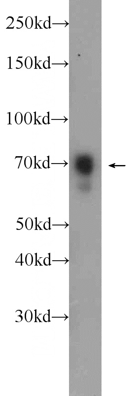 MCF-7 cells were subjected to SDS PAGE followed by western blot with Catalog No:110321(ENOX2 Antibody) at dilution of 1:1000