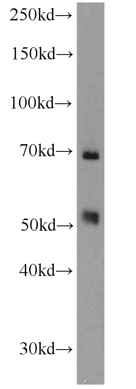 rat liver tissue were subjected to SDS PAGE followed by western blot with Catalog No:112354(LSR antibody) at dilution of 1:1000