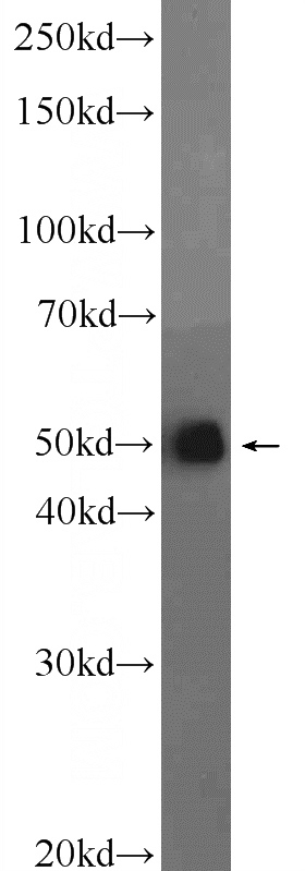HeLa cells were subjected to SDS PAGE followed by western blot with Catalog No:115261(SH3GLB2 Antibody) at dilution of 1:1000