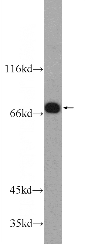 Jurkat cells were subjected to SDS PAGE followed by western blot with Catalog No:111000(GNE Antibody) at dilution of 1:1000