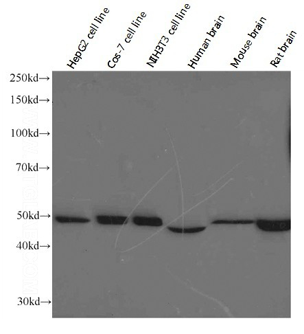 Western blot analysis of ATP5A1 in various tissues and cell lines using Proteintech antibody Catalog No:107071 at the dilution of 1:1000.