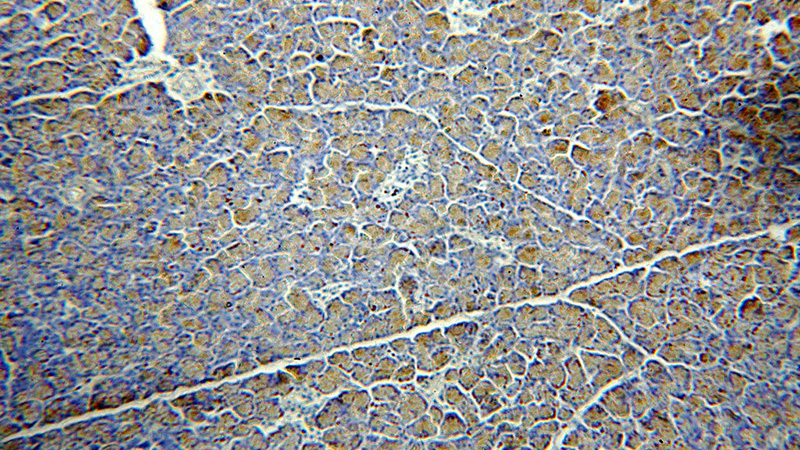 Immunohistochemical of paraffin-embedded human pancreas using Catalog No:109189(CEPT1 antibody) at dilution of 1:50 (under 10x lens)