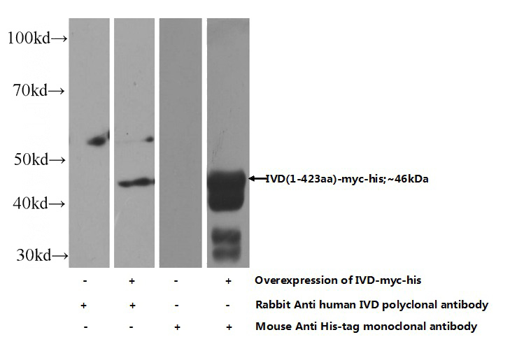 Transfected HEK-293 cells were subjected to SDS PAGE followed by western blot with Catalog No:111962(IVD Antibody) at dilution of 1:500