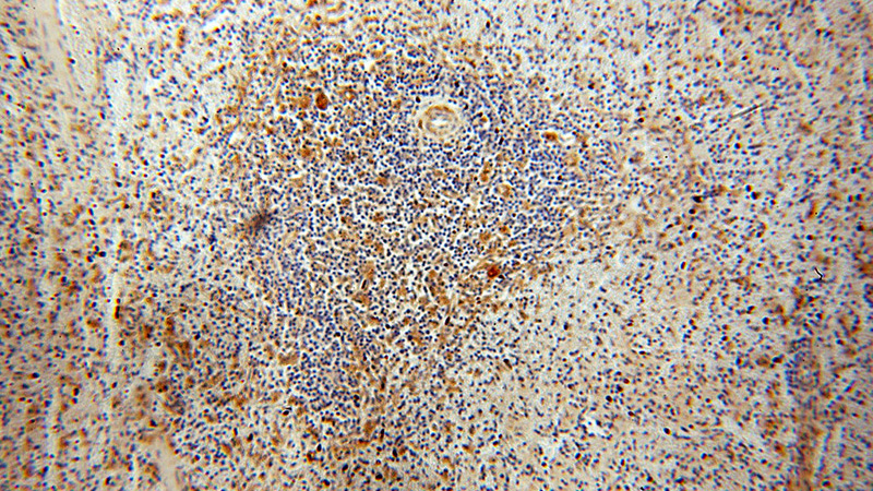 Immunohistochemical of paraffin-embedded human spleen using Catalog No:109986(DLC1 antibody) at dilution of 1:100 (under 10x lens)