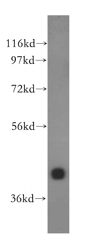 HeLa cells were subjected to SDS PAGE followed by western blot with Catalog No:110089(DNAJB11 antibody) at dilution of 1:500