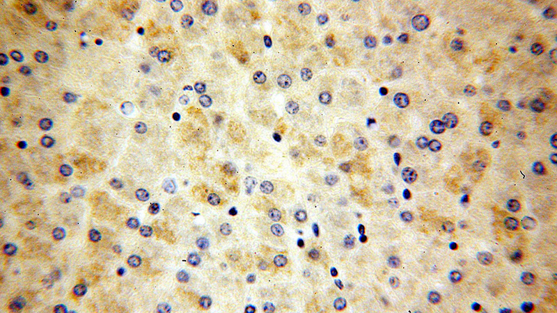 Immunohistochemical of paraffin-embedded human liver using Catalog No:112841(MRPS12 antibody) at dilution of 1:50 (under 40x lens)