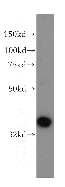 human brain tissue were subjected to SDS PAGE followed by western blot with Catalog No:107677(AASDHPPT antibody) at dilution of 1:400