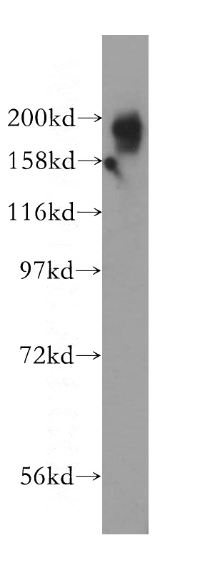 HeLa cells were subjected to SDS PAGE followed by western blot with Catalog No:112004(KIF1B antibody) at dilution of 1:500