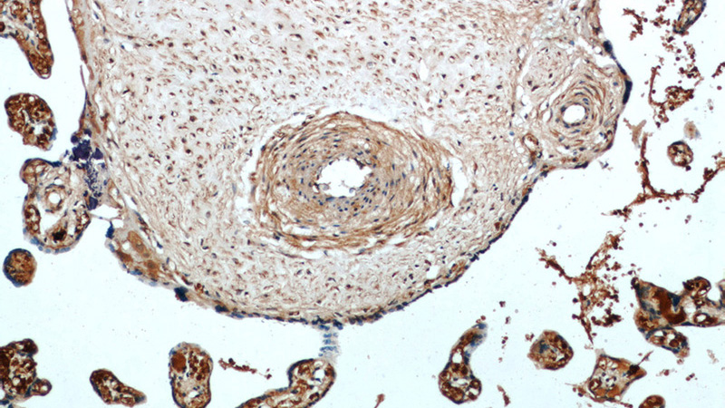 Immunohistochemical of paraffin-embedded human placenta using Catalog No:107045(CD146, MCAM antibody) at dilution of 1:200 (under 10x lens)