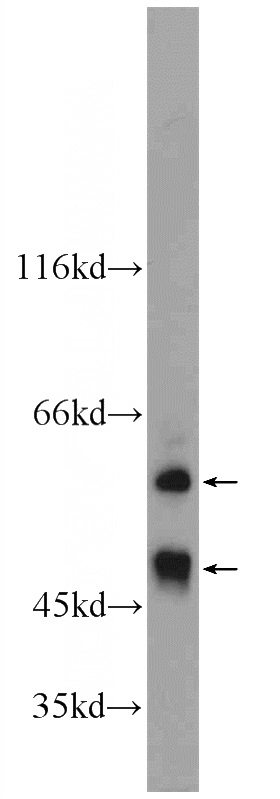 mouse kidney tissue were subjected to SDS PAGE followed by western blot with Catalog No:110420(EYA1 Antibody) at dilution of 1:600