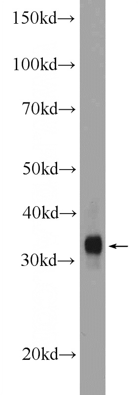mouse skeletal muscle tissue were subjected to SDS PAGE followed by western blot with Catalog No:112997(MYOZ1 Antibody) at dilution of 1:600