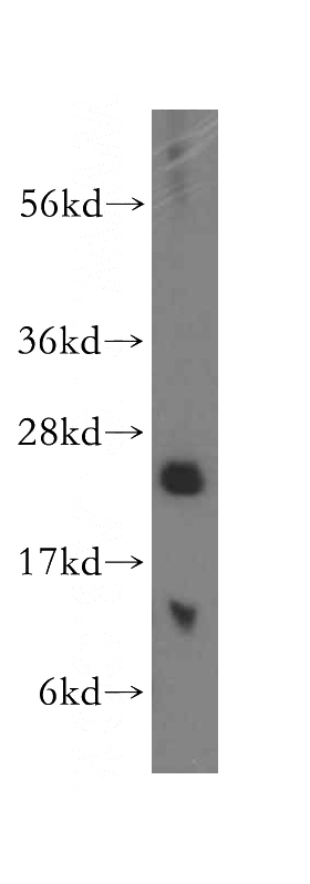 human spleen tissue were subjected to SDS PAGE followed by western blot with Catalog No:108819(CAPS antibody) at dilution of 1:500