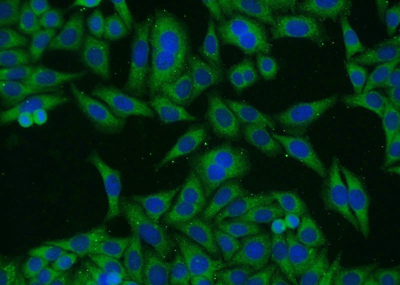 Immunofluorescent analysis of HepG2 cells using Catalog No:115858(TAX1BP1 Antibody) at dilution of 1:25 and Alexa Fluor 488-congugated AffiniPure Goat Anti-Rabbit IgG(H+L)