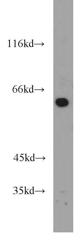L02 cells were subjected to SDS PAGE followed by western blot with Catalog No:109689(CYP27A1 antibody) at dilution of 1:1000
