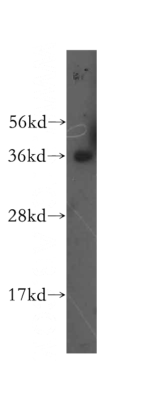 K-562 cells were subjected to SDS PAGE followed by western blot with Catalog No:111085(GYPA antibody) at dilution of 1:500