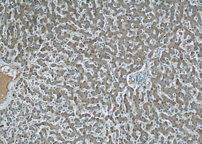 Immunohistochemistry of paraffin-embedded human liver tissue slide using Catalog No:107212(FGG Antibody) at dilution of 1:50 (under 10x lens)