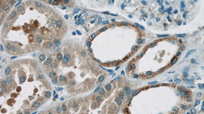Immunohistochemistry of paraffin-embedded human kidney tissue slide using Catalog No:111392(HEATR2 Antibody) at dilution of 1:50 (under 40x lens)