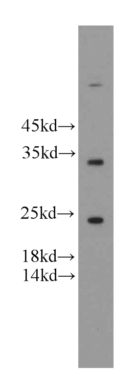 HeLa cells were subjected to SDS PAGE followed by western blot with Catalog No:110636(FGF8 antibody) at dilution of 1:500