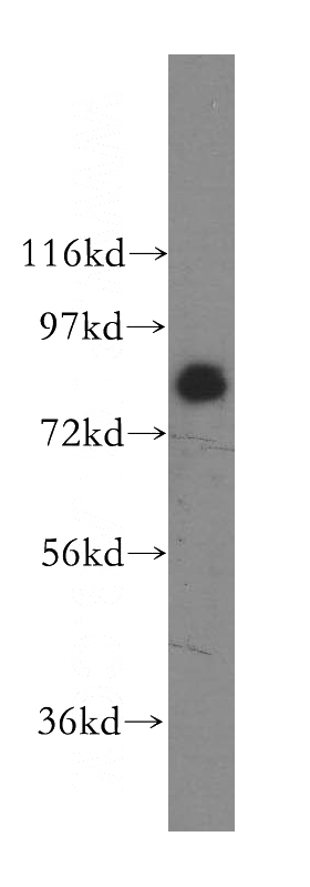 A549 cells were subjected to SDS PAGE followed by western blot with Catalog No:115230(SIK1 antibody) at dilution of 1:400